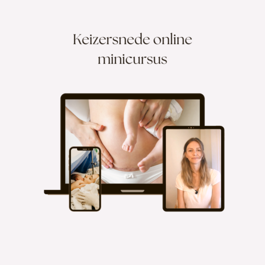Wetenschapsdoula online keizersnede cursus keizersnee sectio caesarea